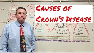 Causes of Crohn’s Disease [upl. by Mert973]