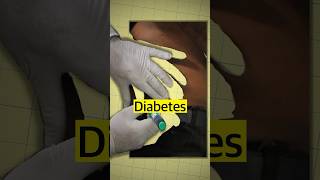 Why South Asians Are More Likely to Get Diabetes [upl. by Aplihs]