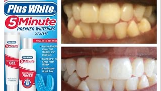 DIY 5 Minute Whitening Review and Demo [upl. by Manuela]