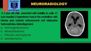 Medulloblastoma II CTMRI findings [upl. by Eseuqram]