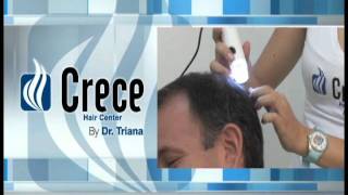 Tratamiento caida del cabello Crece Hair Center by Dr Triana [upl. by Angel]