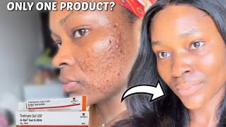 HOW TO ACHIEVE YOUR DREAM SKIN WITH TRETINOIN  How to use Tretinoin for beginners tretinoin [upl. by Arratoon586]