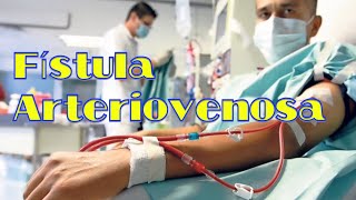 Fístula Arteriovenosa para hemodiálisis [upl. by Salesin]