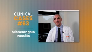 Clinical Cases 63  IPI  NIVO nel melanoma con metastasi cerebrali [upl. by Ynots]