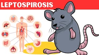 Leptospirosis  Causes Risk Factors Pathology Signs amp Symptoms Diagnosis And Treatment [upl. by Sukey132]