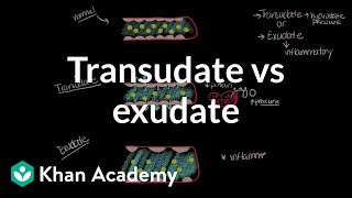 Transudate vs exudate  Respiratory system diseases  NCLEXRN  Khan Academy [upl. by Latty]