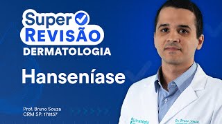 Hanseníase  Super Revisão de Dermatologia e Hematologia [upl. by Rieth231]