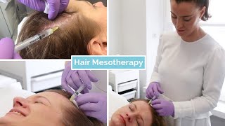 Hair Loss Mesotherapy  The Laser and Skin Clinic [upl. by Toffey]