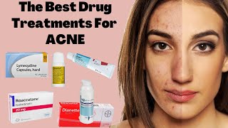 The Best ACNE Treatments  From DUAC to ROACCUTANE  HORMONAL vs BACTERIAL Acne [upl. by Elboa]