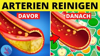 Diese Top 4 Lebensmittel reinigen deine Arterien und helfen bei der Vorbeugung von Arteriosklerose [upl. by Giglio876]