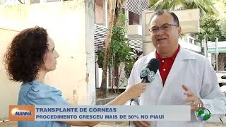 Transplante córneas cresceu mais de 50 no Piauí [upl. by Nnalatsyrc]