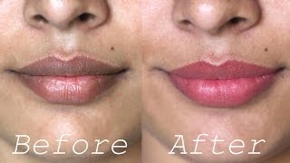 How to Lighten Dark Lips Naturally  Rapid Home Remedies [upl. by Carson]