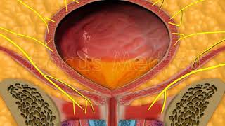 Botulinum toxin injection therapy  Animated Atlas of BPH and OAB [upl. by Eiznik]