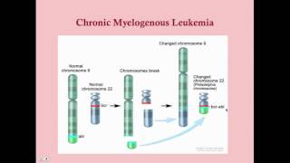 Chronic Myelogenous Leukemia  CRASH Medical Review Series [upl. by Brianna261]