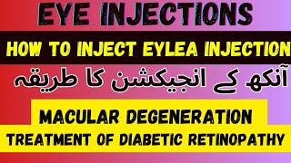 Intravitreal Eylea injection 💉  Intravitreal AntiVegf Injection  Dr Faisal Anwar [upl. by Ilyse]