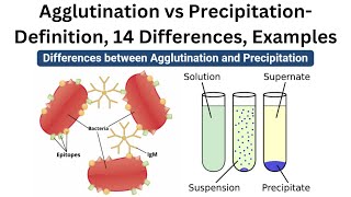 Agglutination vs Precipitation Definition 14 Differences Examples [upl. by Adihahs]