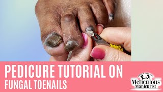 How to Pedicure on Thick Dark Toenails with Nail Fungus [upl. by Kayle]