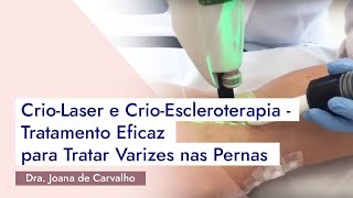 CrioLaser e CrioEscleroterapia  Tratamento Eficaz para Tratar Varizes nas Pernas [upl. by Ettennek130]