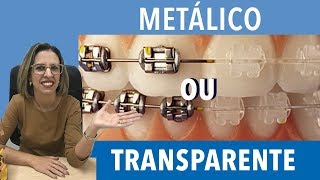 Diferença entre aparelho metal e transparente [upl. by Vick]