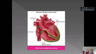 Junctional Tachycardia លោកវេជ្ជ សយ សារៈ [upl. by Melvena]