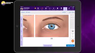 Documenting an Eye Exam in Our Ophthalmology EHR EMA™ [upl. by Wsan]