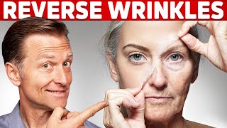 How To Reverse Wrinkles  – DrBerg on Anti Aging Hormones [upl. by Nitsruk507]