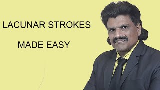 LACUNAR STROKES MADE EASY [upl. by Ahmed195]