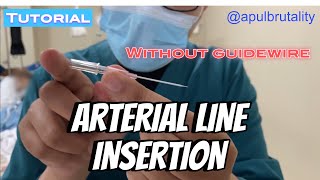 Arterial line insertion without guidewire  tutorial [upl. by Leikeze]