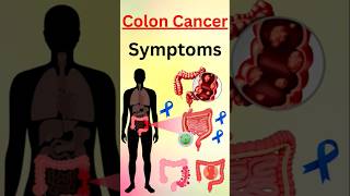 Symptoms You Never Knew Were Linked to Colon Cancer [upl. by Kerby]