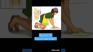 Bursitis Or Housemaid Knee Anatomy Lower Limb [upl. by Soalokin]