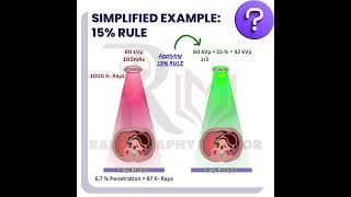 kVp and mAs 15 5 and 10 kVp Rule Optimizing Patient Radiation Exposure and Image Quality [upl. by Olen]