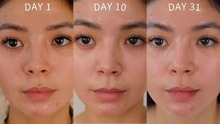 SKINCARE ROUTINE ZO SKIN HEALTH ONE MONTH RESULTS [upl. by Lewes]