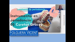 Lecciones de periodoncia Nº3 Curetas Gracey [upl. by Callery435]