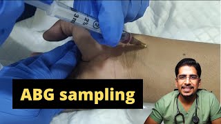 ABG sampling How amp when to do it [upl. by Battista]