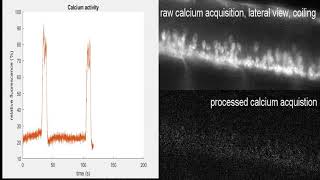 Neuroday 2019 calcium imaging [upl. by Lubbock]