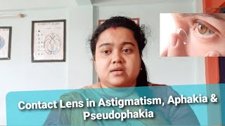 Contact Lens in Astigmatism Aphakia amp Pseudophakia [upl. by Boothe]