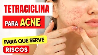 TETRACICLINA PARA ACNE e mais  O que você PRECISA SABER Como Tomar Riscos e Para Que Serve [upl. by Acebber200]