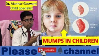 MUMPS  Mumps In Children  how to treat Mumps in children  HINDI [upl. by Belden188]