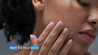 Clear Acne and Prevent New Breakouts │ CeraVe Skincare [upl. by Ayekel833]