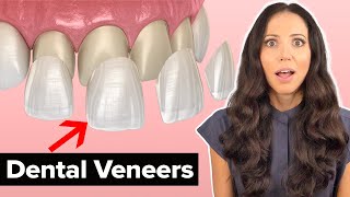 Dental Veneers Procedure Explained [upl. by Aieki566]