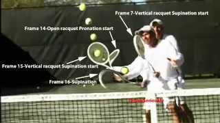 Aggressive forehand volley [upl. by Akers]