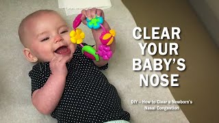 How to Clear Nasal Congestion in Newborns [upl. by Bonina]