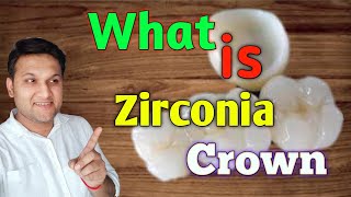 What is Zirconia Crown   Cost of zirconia crown  How long Zirconia crown work [upl. by Anawik283]