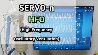 SERVOn ventilator  HFOHigh Frequency Oscillatory Ventilation [upl. by Lindner]