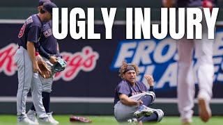 Clevelands Josh Naylor hospitalized after gruesome ankle injury [upl. by Andrel]