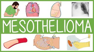 Mesothelioma with mnemonics [upl. by Neetsuj]