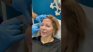 Watch How Botox Can Lift Your Brows INSTANTLY  Beverly Hills Wellness Center amp Med Spa Florida [upl. by Micaela190]