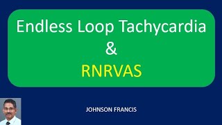 Endless Loop Tachycardia and RNRVAS [upl. by Lorenzo448]