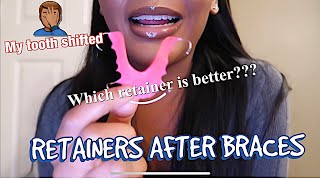 BRACES UPDATE  HAWLEY RETAINER VS CLEAR RETAINER [upl. by Akalam]