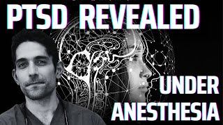 PTSD Uncovering Under Anesthesia A True Story [upl. by Gnok]